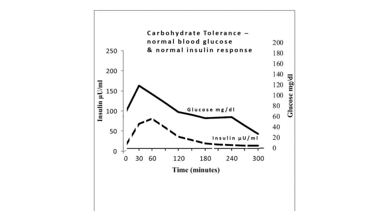 The Three Stages Of Carbohydrate Intolerance - Before Type 2 Diabetes